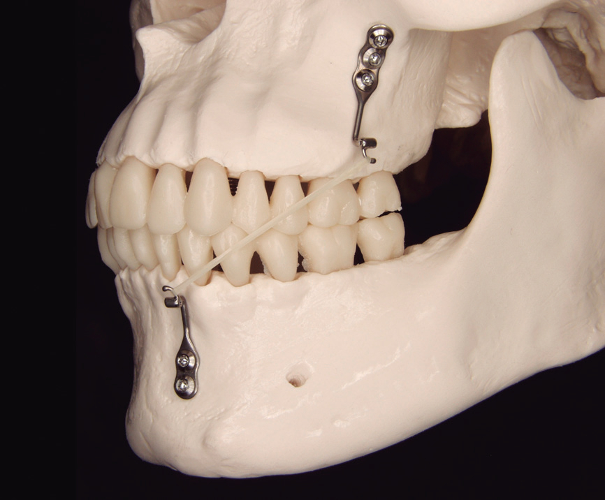 Simposio de Cirugía Bucal y Ortodoncia